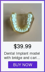 Alta Qualidade Dental Typodon Dentes Modelo - Ortodôntico Steelteeth M8017 7 Cheap Modelo de Ensino Dental
