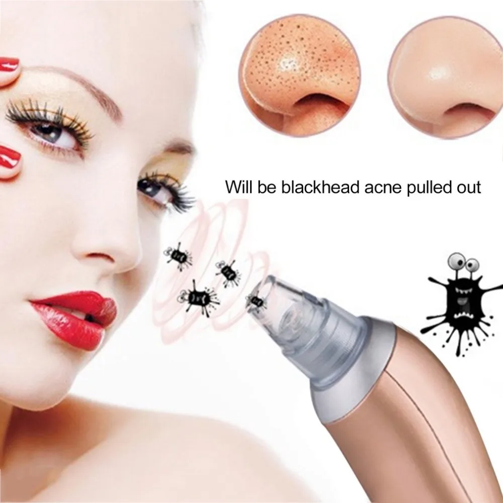 Blackhead Removal Electric Facial Vacuum Pore Cleaner Spot Acne Remover Vacuum Suction Extraction Face skin care tool