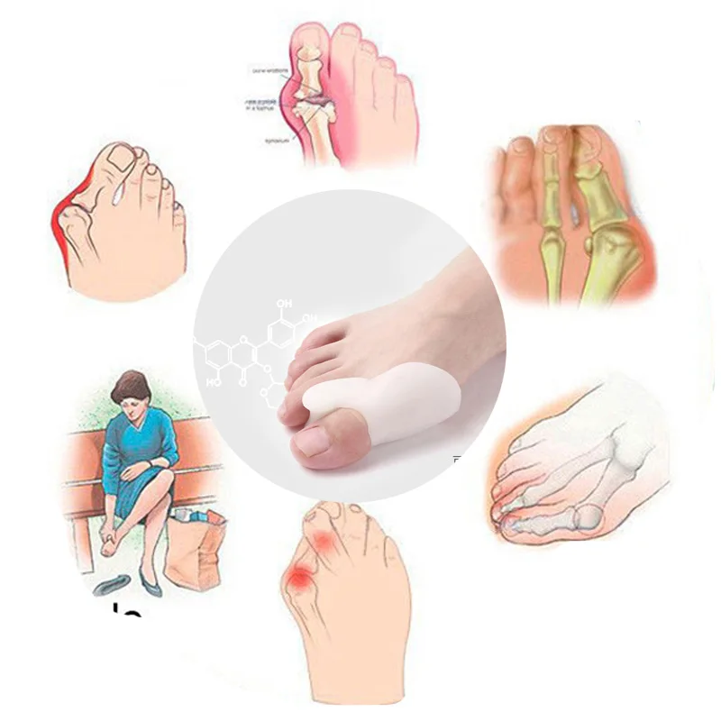 Hallux вальгусный корректор горячая Распродажа уборочная дробилка для костей Ectropion