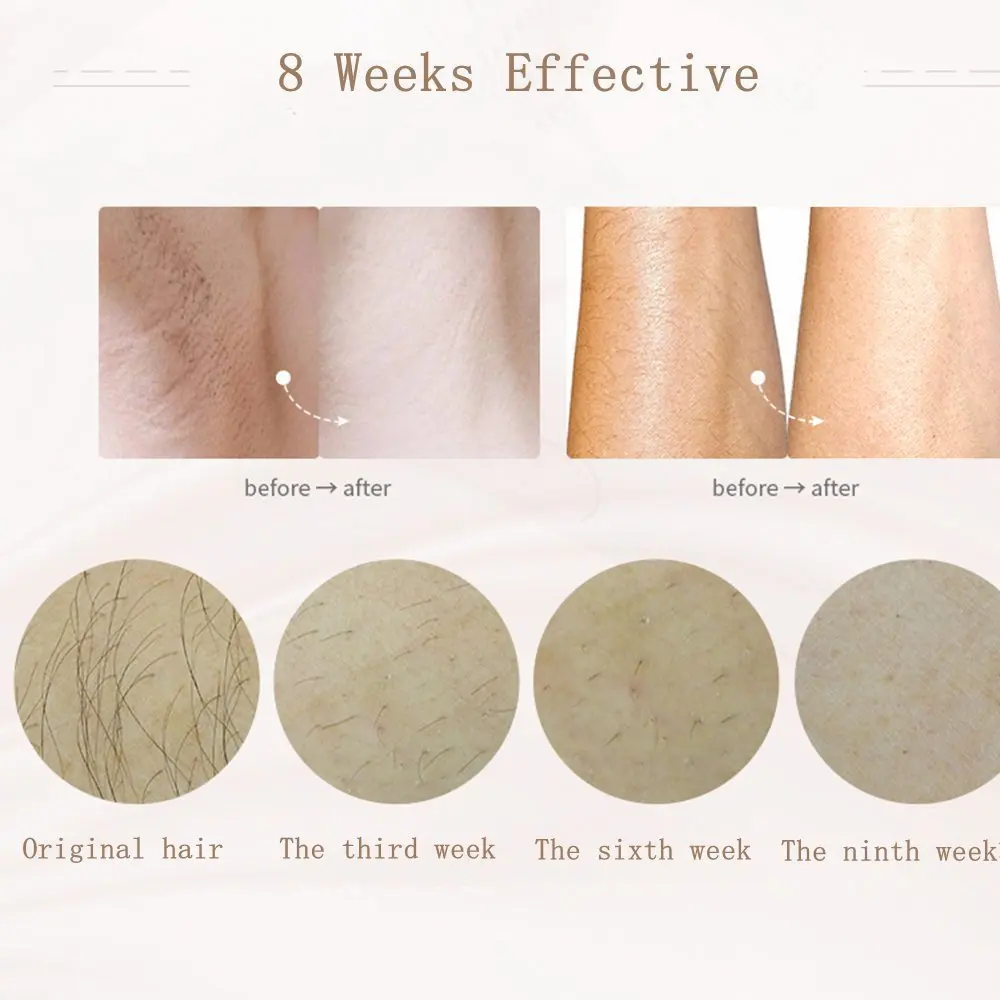 Elétrico a Laser Dispositivo de Beleza Depilador Tipos Permanente Indolor Depilação Rosto Corpo Axila Bikini Uso Doméstico Ipl 3 5 tipos permanente indolor depilação rosto corpo axila