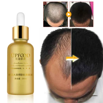 

100% Growth Oils Essence Original Authentic Hair Loss Liquid Health Care Beauty Dense Hair Growth Serum Hair Care Y1