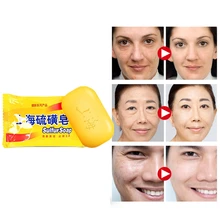 Мощный 85 г Шанхай серное мыло условия кожи от акне, псориаза Себорея клещей против грибка уход за телом