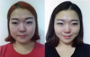 

24pcs/12bags face slimming pad patch face slimming cheeks swelling mitigation Detox Adhesive Sheet Wonderful face slimming patch
