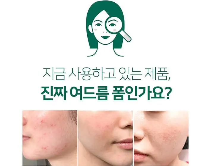 Некоторые MI ана BHA ПГА 30 дней чудо Acne Clear пены 100 мл для удаления угрей акне