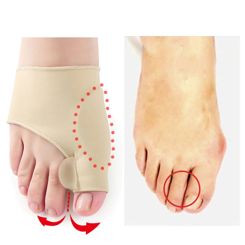 Putimi 2 шт корректор вальгусной деформации для пальцев ног сепаратор пальцев ног профессиональные силиконовые ортопедические инструменты большая кость пальца ноги без мозолей