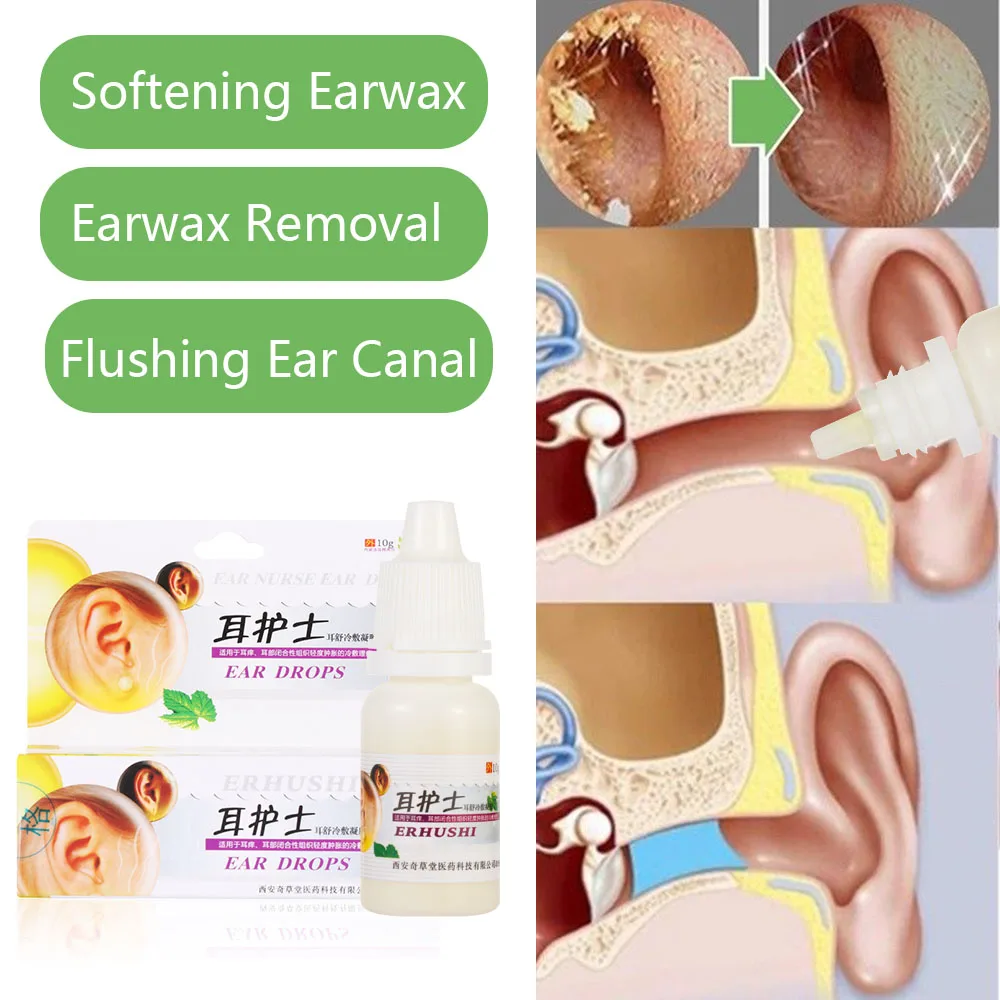 15 мл/бутылка для ушей, жидкий острый отит, капли, китайская травяная медицина для ушей в ушах, глухота, больное здоровье, забота