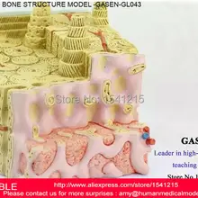Микродиссекции костного мозга структурных медицинское учение ортопедии человека структуру кости человека рассечение модели GASEN-GL043