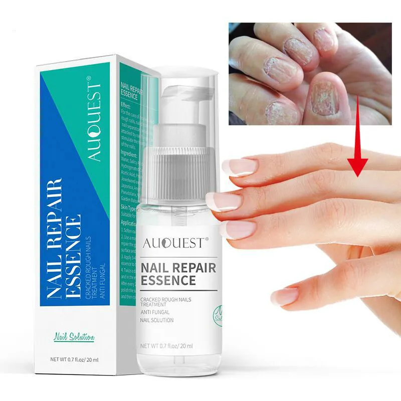 

Nail Tip Remover Moisturizing for Nail Foot Care 30ml Natural Bactericidal Oil Essence Nail Repair Liquid Fungus Treatment TSLM1