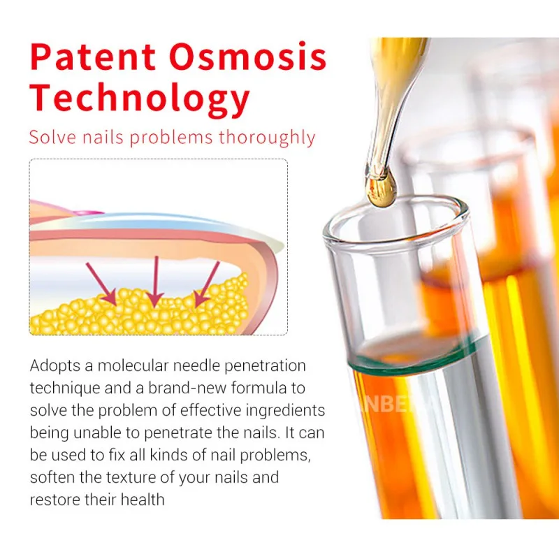 Ручка для лечения Ногтей эффективный Onychomycosis Paronychia гриб инфекция Восстанавливающий раствор гель Ногти Уход за ногтями
