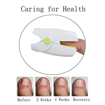 

Low Level Laser Therapy Device Anti Fungal Onychomycosis Treatment Instrument