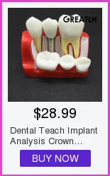 Modelo padrão dental com dentes removíveis #4004