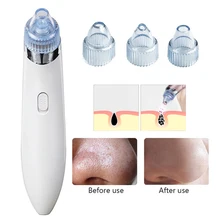 Очищающая маска для лица Электрический удаления угрей очиститель пор черный точка всасывания лица Нос акне пилинг уход за кожей Инструменты