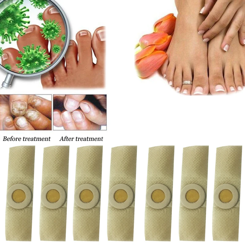 

20PCS Paronychia Onychomycosis Nail Treatment Herbs Antifungal Prevent Infection Nail Fungus Cuticle Soften Corrector Manicure