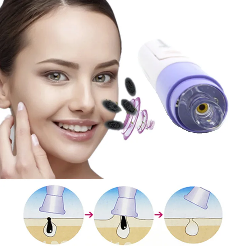 

Electric Facial Pore Cleanser Skin Cleaner Face Dirt Suck Up Vacuum Acne Pimple Remover Blackhead Clean Massage Tools Mini