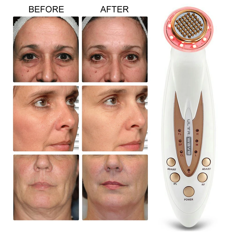Thermage лифтинг для лица красота машина удаление морщин Подтяжка кожи тела массажер
