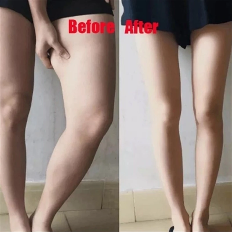 10PCS  Weight Loss Slimming Diets Chinese Medicine Slim Patch Pads Detox Adhesive Sheet Lost Weight (2)