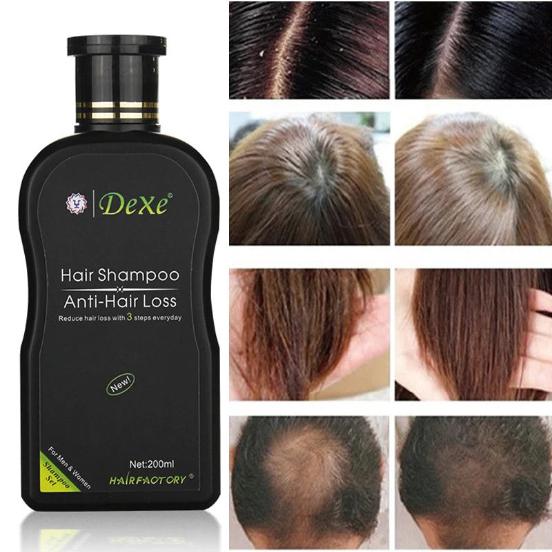 200 мл Dexe шампунь для волос набор против выпадения волос Китайский травяной средство для роста волос Предотвратить лечение волос для мужчин t