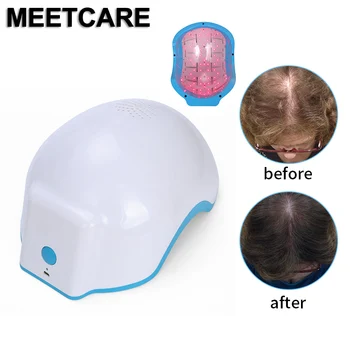 

Therapy Laser Hair Growth Helmet Anti Hair Loss Device 80 Diodes Laser Hair Regrowth Brush Helmet Treatment Laser Cap Massage