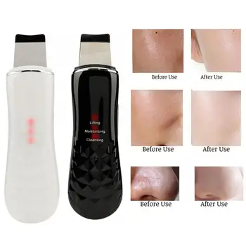 

Ultrasonic Skin Scrubber Massager Machine Facial Pore Cleaner Deeply Cleaning Blackhead Removal Lifting Skin Rejuvenation Device