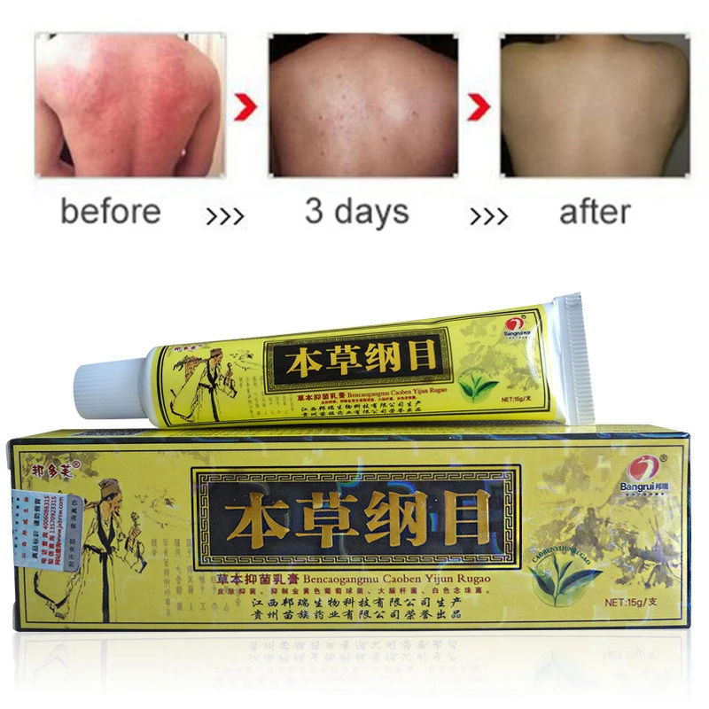 

Advanced Body Psoriasis Cream Perfect For Dermatitis and Eczema Pruritus Psoriasis Ointment Herbal Creams