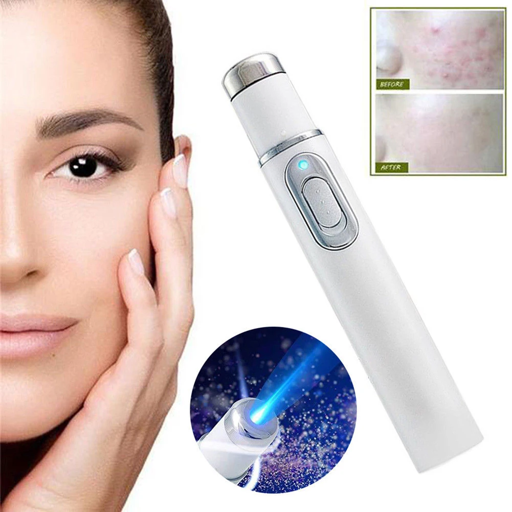 new 1pc medical blue light laser therapy acne treatment acne light therapy skin station