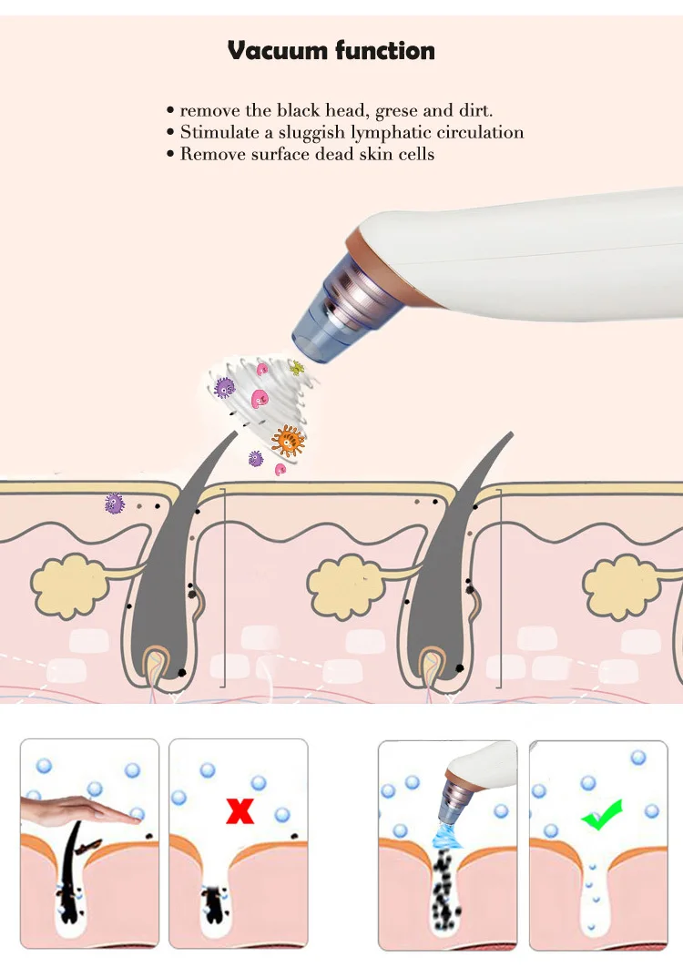 Электрический инструмент для удаления чёрных точек поры вакуумный очиститель кожи кисточка для чистки пор USB Перезаряжаемые инструмет для удаления черных точек инструмент