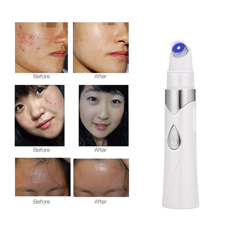 “ Tratamento do Ponto Remoção Instrumento Pen Facial Médico