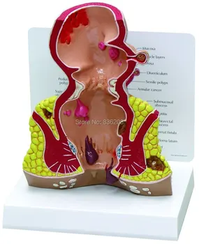 

enlarged pathologies model of rectum Model Anatomical anatomy skeleton veterinary esqueleto humano anatomia