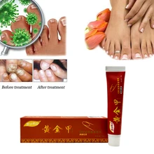 Лучший Крем для лечения грибок ногтей, против грибковой инфекции, против грибковой инфекции, против бактерий и грибков