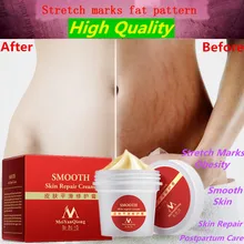Smooth Skin Cream For Stretch Marks Scar Removal To Maternity Skin Repair Cream Remove Scar Care Postpartum