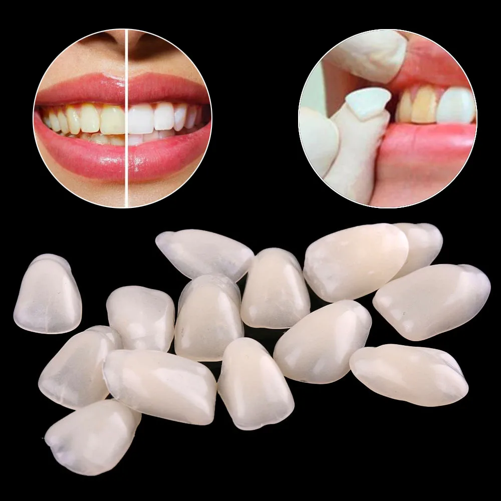 10 шт. зубные виниры для зубов ультра тонкие отбеливающие смолы Верхняя Нижняя Временная Корона фарфоровый Стоматологический материал для ухода за полостью рта Z250
