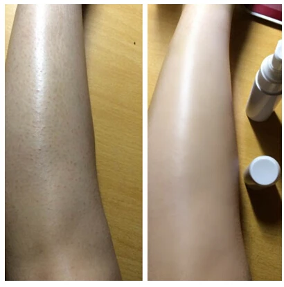 moisturizing whitening lotion