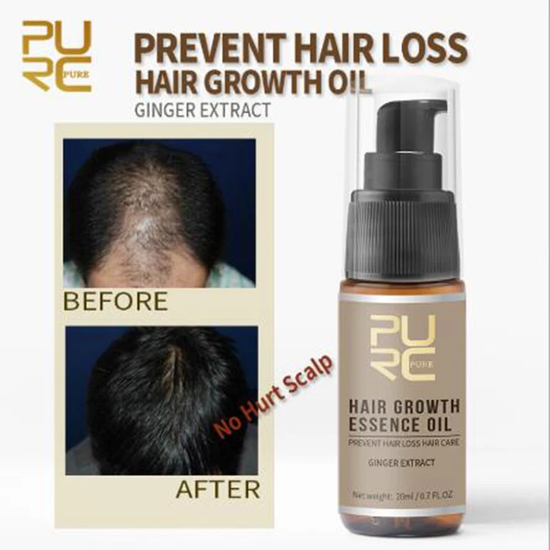PURC Fast Hair Essence Oil Anti-hair Loss Treatment Helps Hair Growth Maintain Hair 20 ml PURC Fast Hair Essence Oil Anti-hair Loss Treatment Helps Hair Growth Maintain Hair 20 ml