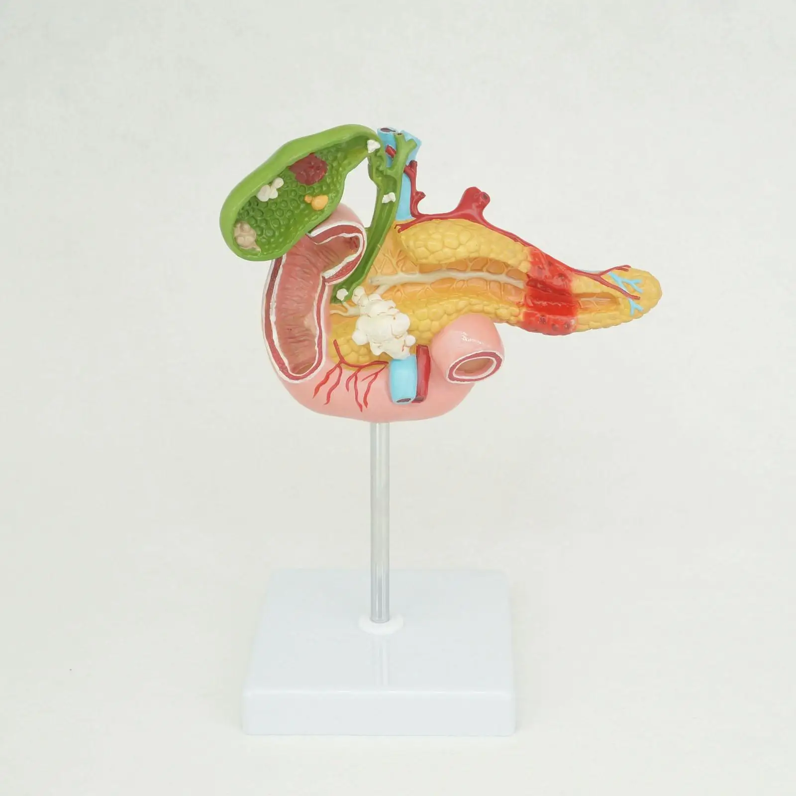 Human Anatomical Duodenum Gall Bladder Disease Anatomy Medical Model ...
