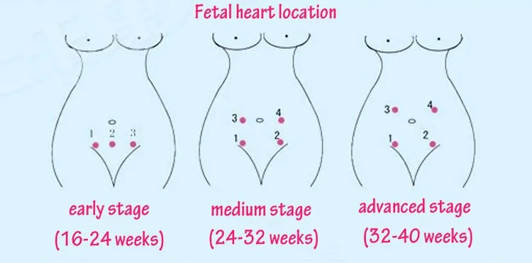 Vcomin хит Средства ухода за мотоциклом карман фетальный Doppler младенца Heart Rate Мониторы пренатальная ultrasoud Детектор плода 2 мГц зонд Встроенный динамик