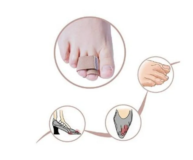 

1000pcs/lot Fabric Toe Finger Hammer Toe Hallux Valgus Corrector Bandage Broken Toe Protector Separator Splint Wraps