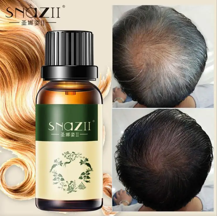 

Hair Growth anti Hair Loss Liquid 30ml dense hair fast sunburst hair growth grow