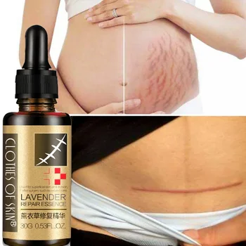 

Scar Repair Skin Essential Oil Lavender Essence Skin Care Natural Pure Remove Ance Burn Strentch Marks Scar Removal 30g