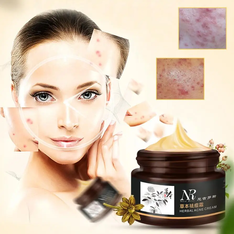 NR Removal Blemish Facial Effective Herbal Acne Cream Treatments Care
