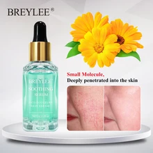 BREYLEE Repairing Serum Sensitive Skin Remove Fade Redness Treatment Soothing Whitening Face Skin Care Acne Scar Snail Serum   
