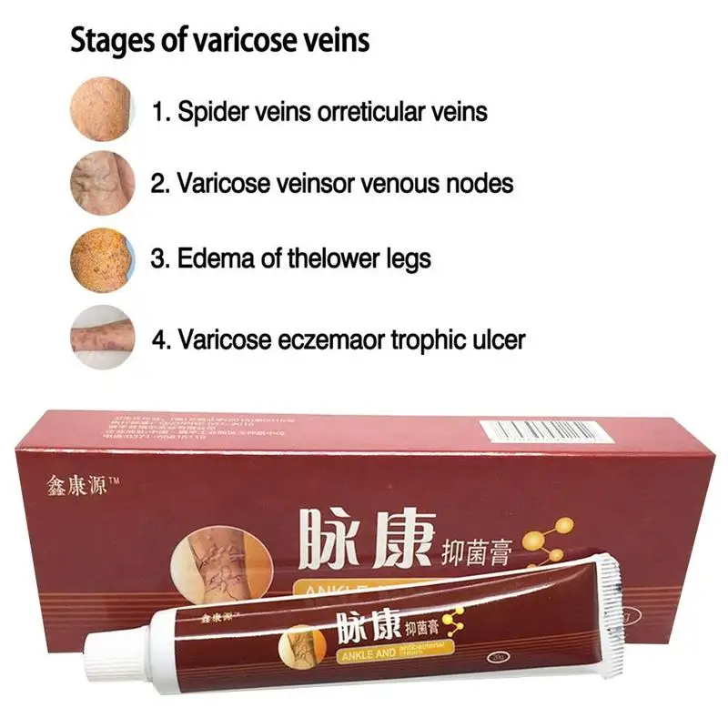 20g Varicose Veins Treatment Cream Ointment Vasculitis Phlebitis Spider Pain Varicosity Angiitis Remedy Removal Herbal Cream