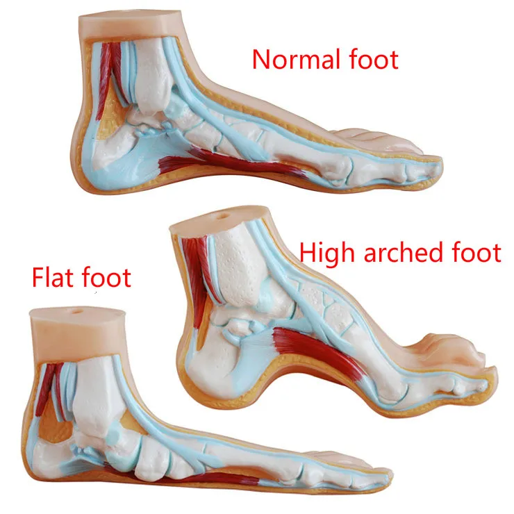Medical Anatomy Human Foot Normal Foot Flat and Arched Foot Anatomy