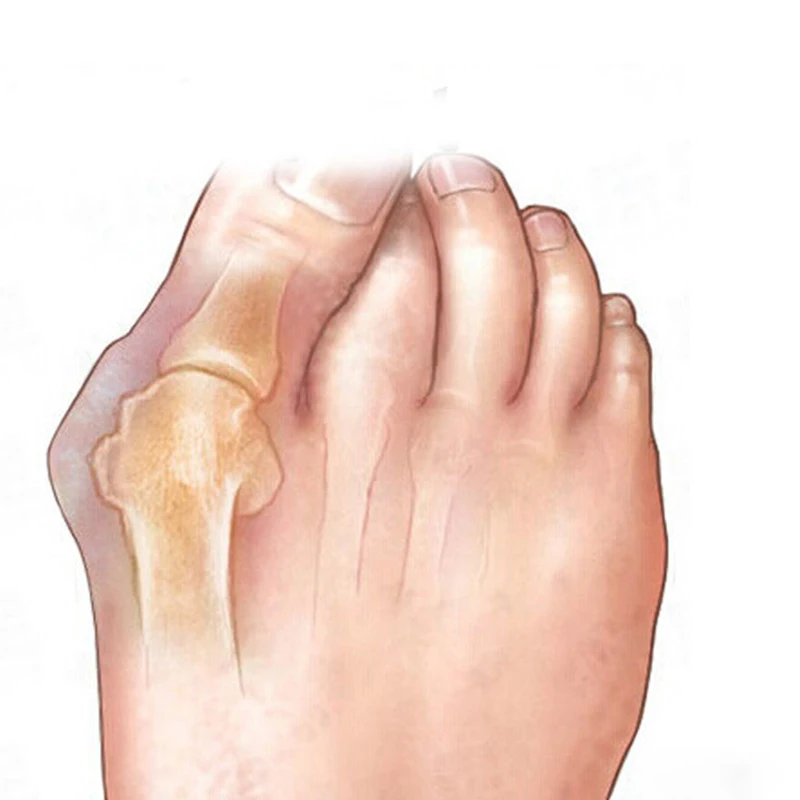 

Gel Toe Separator Health Orthopedic Spreader Feet Care Bunion Corrector Hallux Valgus Shoe Toe Protector Foot Care Tool
