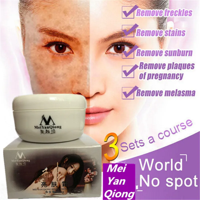 40g MeiYanQiong Anti Aging Face Care Cream Dark Spot Remover Skin Lightening Cream Dark Skin Care Anti Freckle Whitening Cream