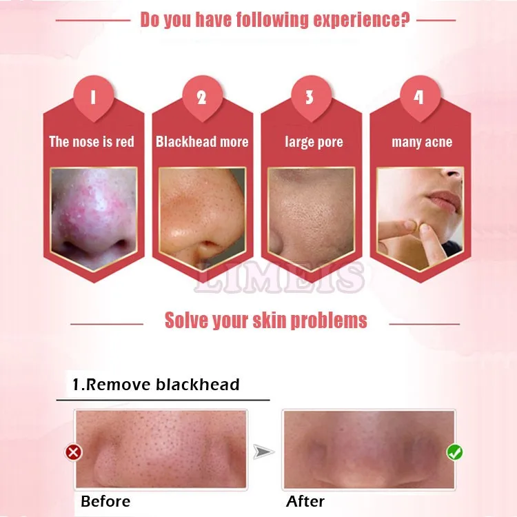 electric facial cleaning machine face washing blackhead remover skin cleanser machine
