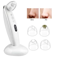 Вакуумный Очиститель пор электрический прибор для удаления черных точек всасывающий очиститель пор средство для удаления черных точек лица удалитель угрей