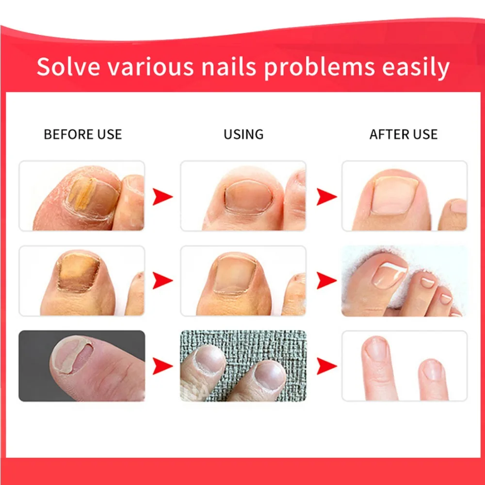 Крем для ногтей купить. Протекторы для ногтей. Nail Protector для ногтей. Крем для ногтей.