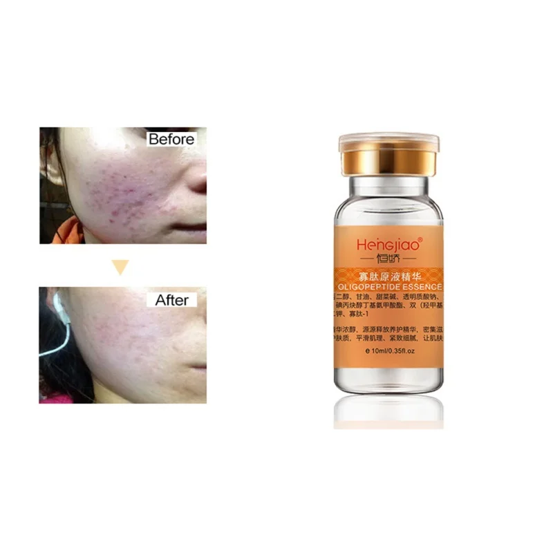 

Pure Natural EGF Serum Shrinking Pores Remover Scars Pimple Marks Skin Repairing Essential Liquid Easy To Absorb