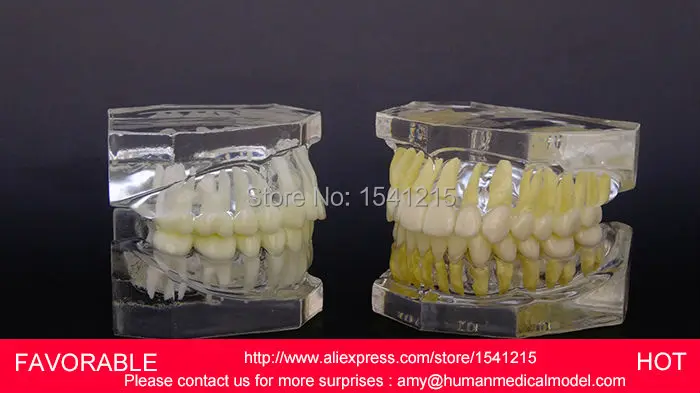 

TEETH DENTAL MODEL DENTURES DENTAL TEACHING MODEL DENTAL ,MALOCCLUSION CLASSIFICATION DEMONSTRATES DENTAL MODEL-A-GASEN-DEN058