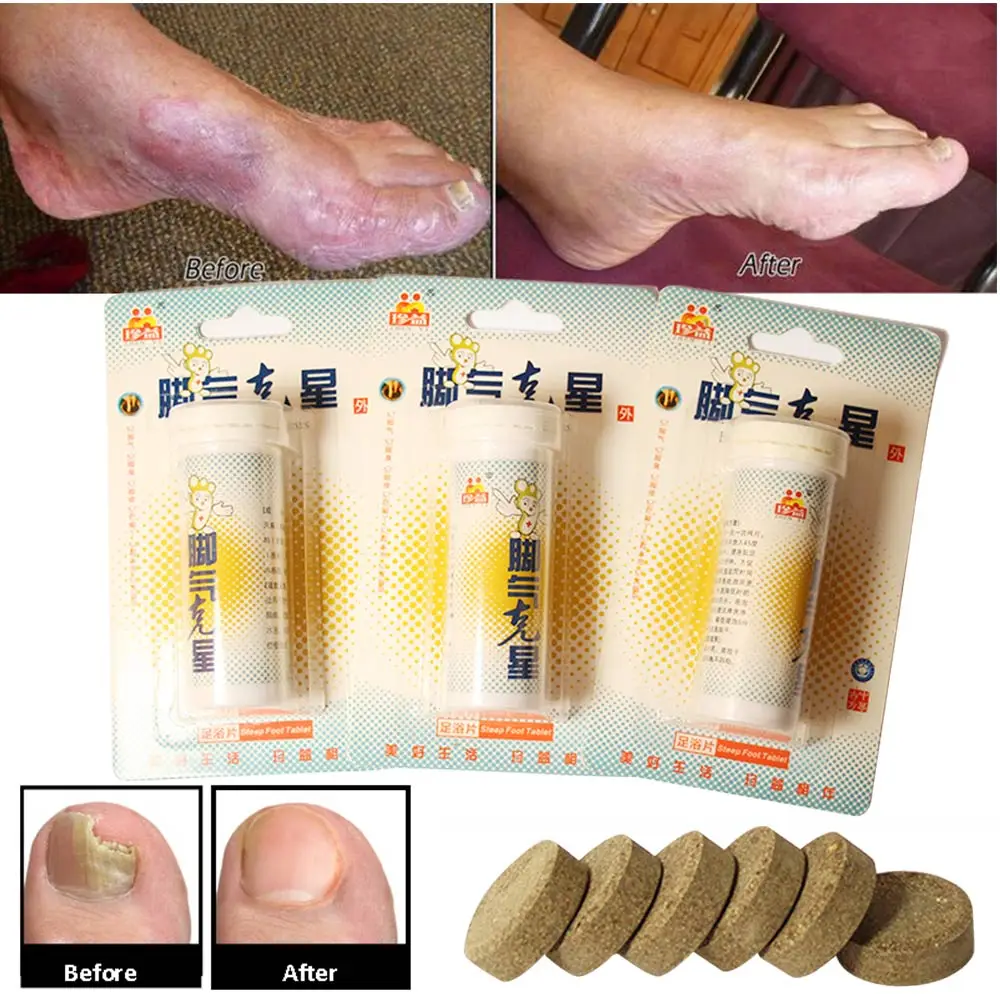 Fungal Nail Treatment Detox Foot Soak Long Term Relief Athlete's Foot